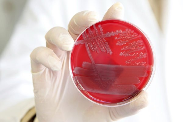 Популярное: All American Meats' retira carne picada por riesgo de contaminación con E.coli