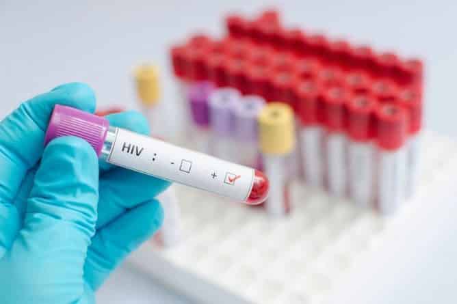 Здоровье: Ученые приблизились к созданию лекарства от ВИЧ и СПИД