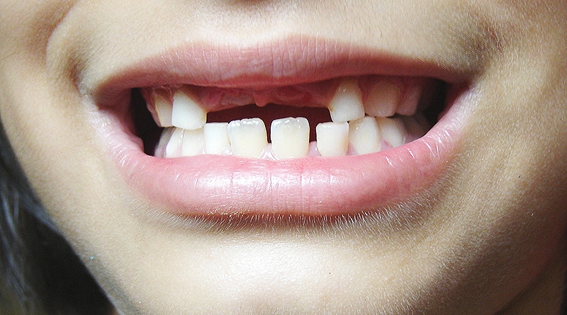 Общество: Твит о зубной фее, которая не заплатила за зуб, стал вирусным