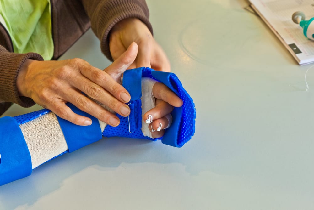 Полезное: hand physiotherapy to recover a broken finger