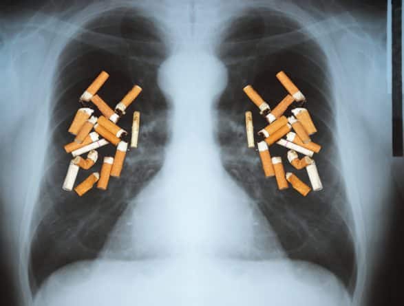 Общество: Американские табачные компании теперь обязаны сообщать, что курение убивает