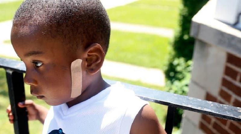 Происшествия: 5-летний мальчик из Чикаго получил огнестрельные ранения дважды за последние 2 года