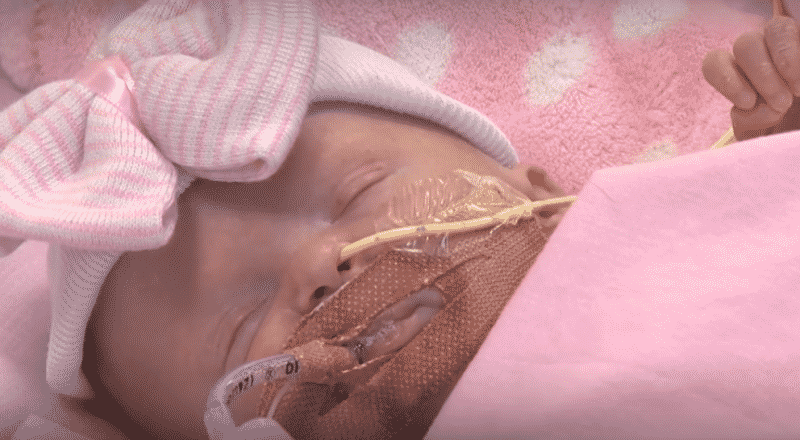 В мире: Впервые в истории британские медики спасли ребенка, родившегося с сердцем за пределами тела