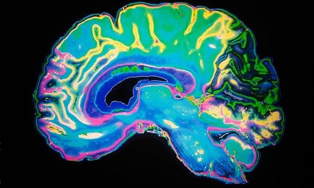 Наука: Новый взгляд: ученые подтвердили, что вирус герпеса провоцирует болезнь Альцгеймера