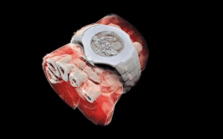 Технологии: Ученые создали первый в мире 3D-рентген