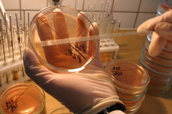 Наука: Ученые предупредили об экспансии супербактерий, способных убивать до 30 тыс. американцев в год рис 2