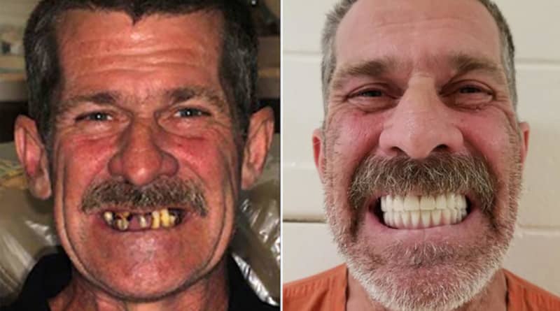 Происшествия: Мужчина украл чужую личность, чтобы сделать новые зубы за $40 тыс. и купить щенка