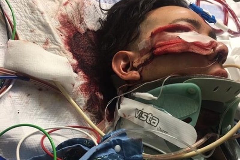 Происшествия: «Я здесь, чтобы убить мексиканца!»: житель Юты железной трубой избил латиноамериканцев