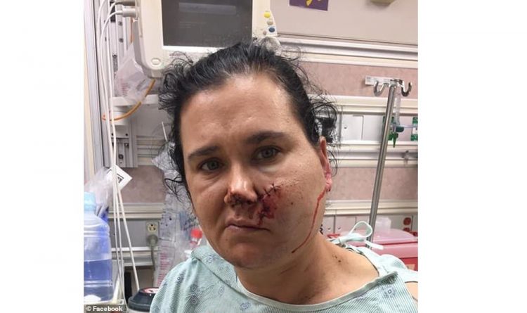 Происшествия: Женщина выжила после того, как ей в лицо выстрелили из арбалета, насквозь пробив голову