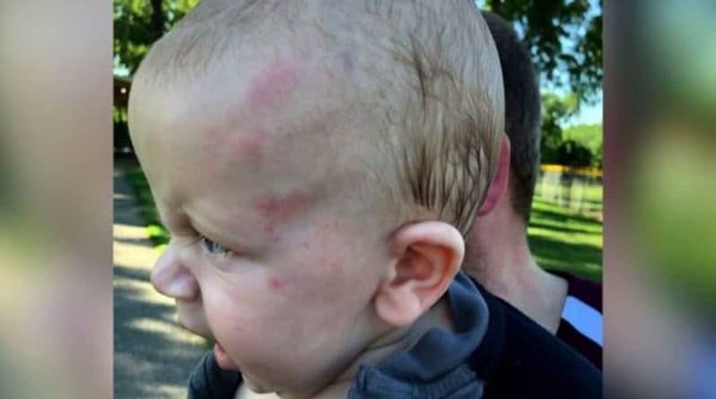Здоровье: Полиция расследует работу детского сада после того, как у 6-месячного ребенка нашли кровоизлияние в мозг