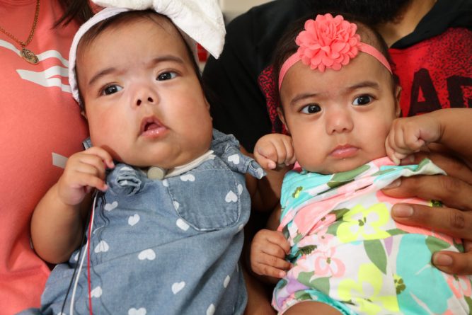 Здоровье: Врачи спасли близнецов, проведя уникальную, но рискованную операцию по удалению огромной опухоли во время родов