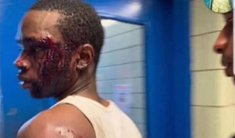 Происшествия: На вирусном видео офицеры NYPD жестоко избивают и прижимают лицом к асфальту афроамериканца