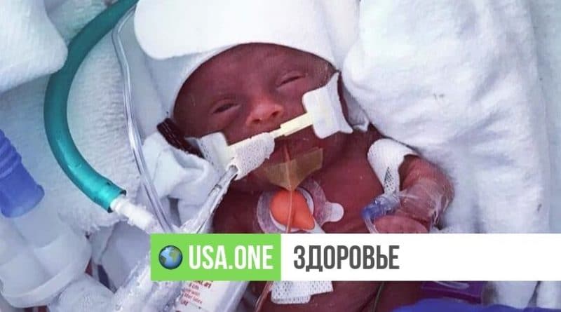 Здоровье: Недоношенный ребенок, который при рождении весил 500 г, вернулся домой после 113 дней в отделении интенсивной терапии