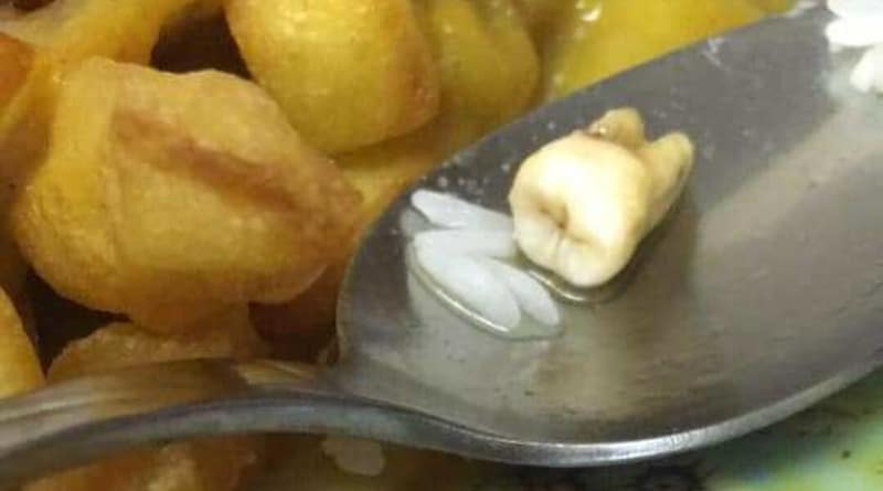 В мире: Пара была шокирована, обнаружив в заказанной китайской еде человеческий зуб (фото)