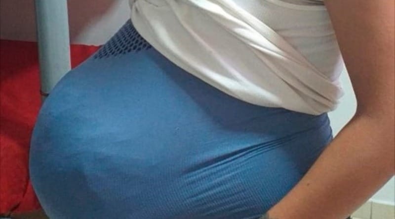 В мире: Девушка сделала себе живот беременной, чтобы спрятать там 4 килограмма наркотиков (фото)
