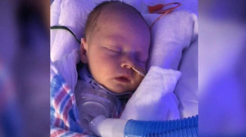 Здоровье: Новорожденный не мог издать ни звука, родившись со сращенными голосовыми связками