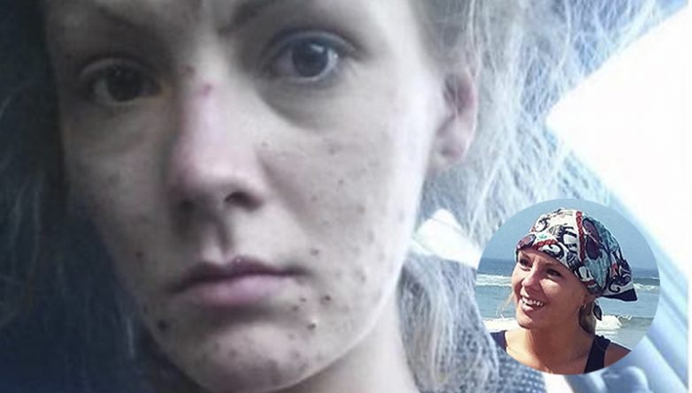 Здоровье: «Надежда есть»: Бывшая наркоманка поделилась невероятными фотографиями «до» и «после»