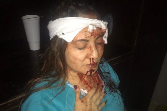 Закон и право: Ужасающие снимки: бывший управляющий Amazon жестоко избил битой супругу до ее убийства