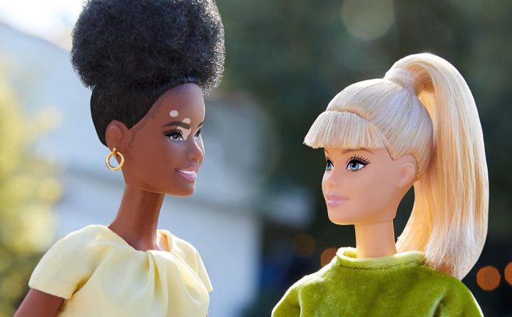 Полезное: Barbie выпустит кукол с витилиго, лысиной и золотым протезом