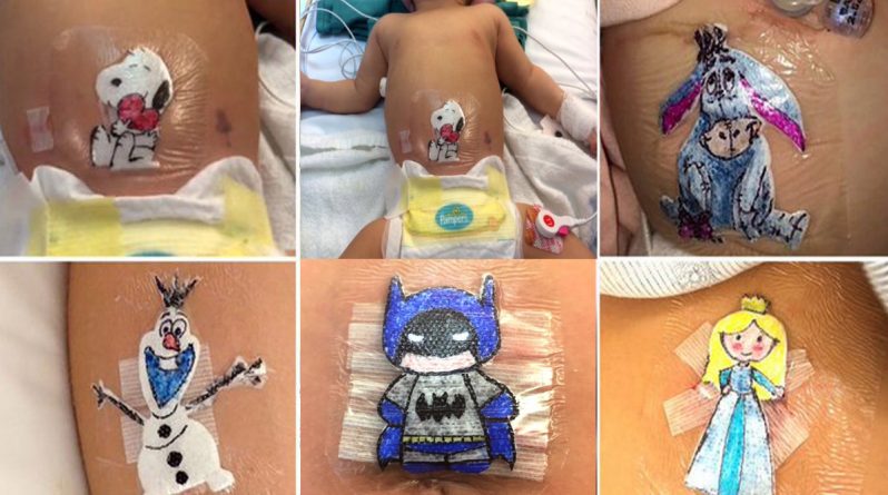 Здоровье: Детский хирург из Огайо рисует сказочных персонажей на повязках, чтобы дети не боялись шрамов после операций