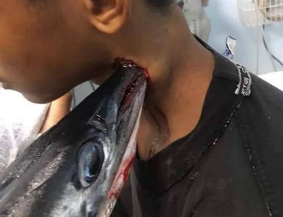 В мире: Выпрыгнувшая из воды рыба-игла пронзила мальчику-подростку шею насквозь