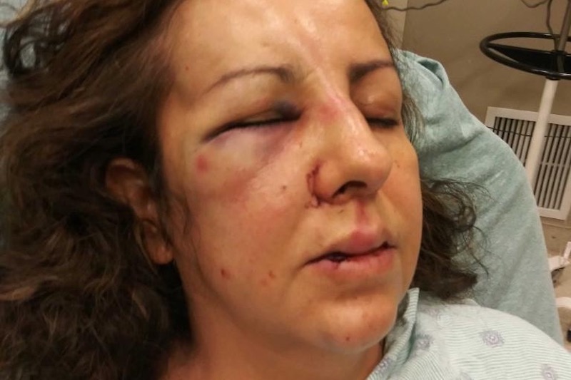 фотография лица Марии после нападения