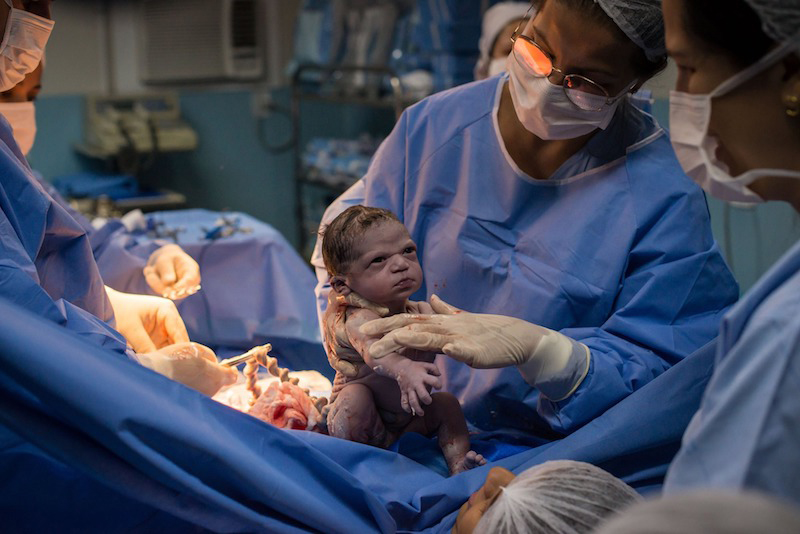 фотография малышки, которая смотрит на врача после родов
