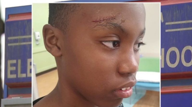 Закон и право: Школьнику наложили 6 швов на голову из-за ссоры с учителем, утверждает мама ребенка