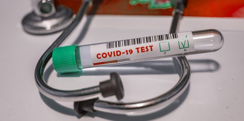 Локальные новости: В одном из городов Калифорнии на коронавирус и антитела тестируют всех жителей