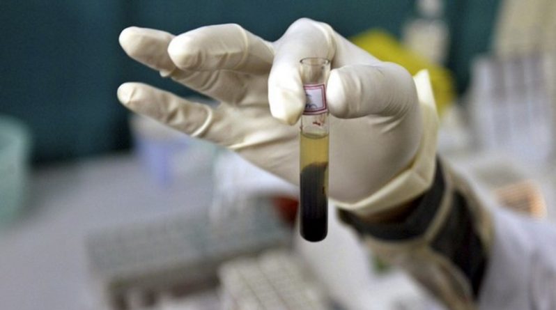 Здоровье: В Хьюстоне провели экспериментальное переливание плазмы для лечения коронавируса