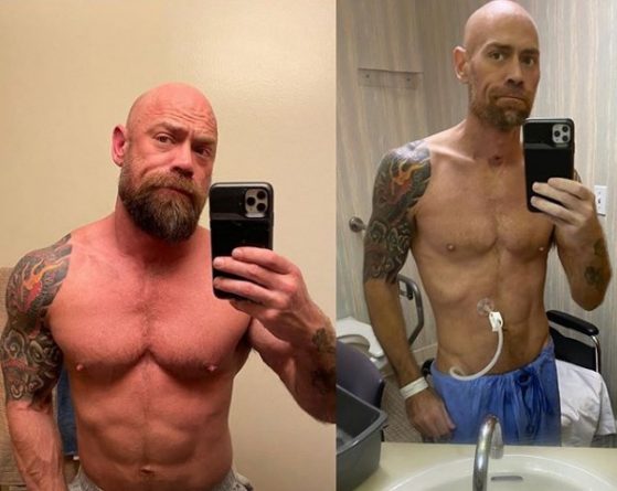 Здоровье: Выживший после коронавируса мужчина поделился шокирующими фото изменений своего тела