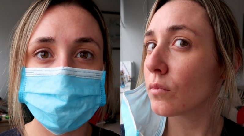 Здоровье: Пандемию коронавируса связывают с новым побочным эффектом из-за использования масок для лица