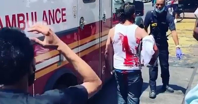 Локальные новости: На вирусном видео мужчина ходил с ножом в голове после нападения грабителей в Нью-Йорке