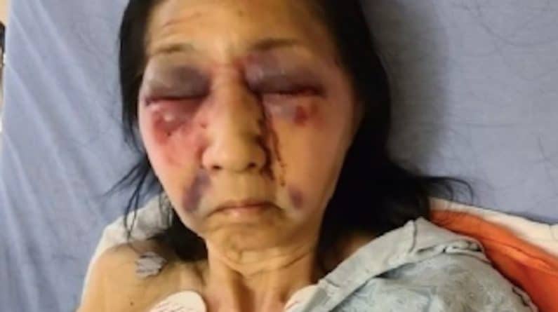 Происшествия: 70-летнюю женщину избили в автобусе, приняв за азиатку