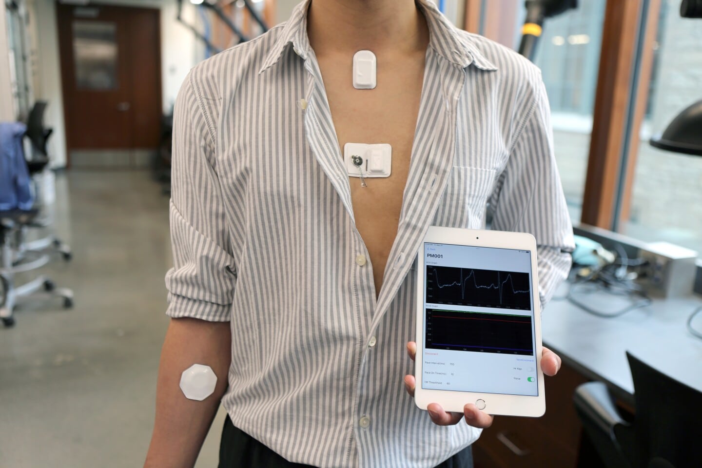 В США создали беспроводной саморастворимый кардиостимулятор